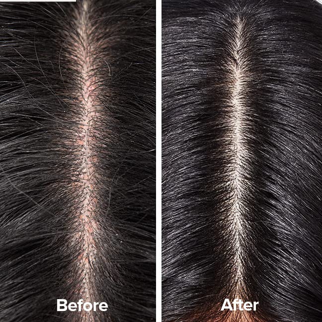Scalp Therapy Shampoo D1662
